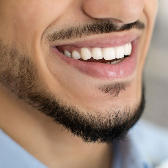 Dental Fillings in New York to Fix Your Cavities